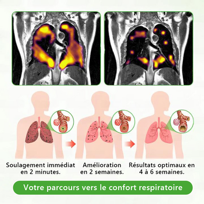 𝐃é𝐭𝐞𝐧𝐮𝐞 𝐞𝐭 𝐞𝐱𝐩𝐥𝐨𝐢𝐭é𝐞 𝐩𝐚𝐫 𝐥𝐚 𝐁𝐞𝐥𝐠𝐢𝐪𝐮𝐞✅ 𝑴𝒖𝒓𝙬𝙤𝐧® 𝑫𝒊𝒇𝒇𝒖𝒔𝒆𝒖𝒓 𝒅𝒆 𝑵𝒆𝒕𝒕𝒐𝒚𝒂𝒈𝒆 𝑷𝒖𝒍𝒎𝒐𝒏𝒂𝒊𝒓𝒆 à 𝒍𝒂 𝑴𝒐𝒍è𝒏𝒆 𝑩𝒐𝒕𝒂𝒏𝒊𝒒𝒖𝒆 (🫁 Toux, Pharyngite, essoufflement, expectorations, nez bouché, bronchite, symptômes allergiques, gêne pulmonaire)1🎉🎉