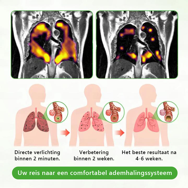 Officiële winkel✨𝗠𝘂𝒓𝑤𝗈𝗇® Botanische koningskaars longreinigingsdiffuser (🫁 Hoest, faryngitis, kortademigheid, slijm, verstopte neus, bronchitis, allergische symptomen, longongemak)3🎁