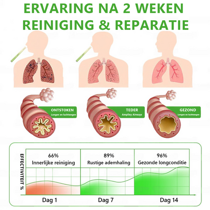 Beperkte tijd, opnieuw 30% korting op het tweede artikel 🔥 𝗠𝘂𝒓𝑤𝗈𝗇® Botanische koningskaars longreinigingsdiffuser